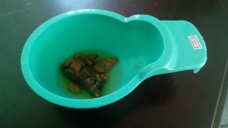 Toddler with a small potty seat, illustrating potty training tips